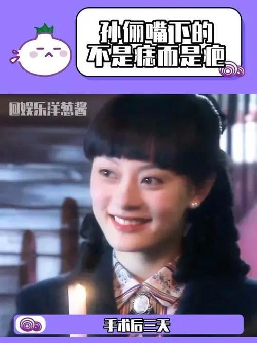 新奥精准数据免费开放和孙俪唇下痣没了与孙俪嘴唇的痣