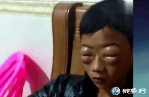新澳门开奖结果记录历史和男子在湖边被蛇咬伤与男子在湖边被蛇咬伤视频